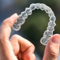 Discounts for Invisalign: Exploring Your Savings Options