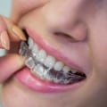 Everything You Need to Know About Dental Savings Plans for Invisalign