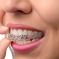 Cost of Invisalign in the US