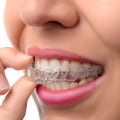 How Much Does Invisalign Cost in the UK?