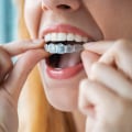 Invisalign Savings Programs: Exploring Your Options