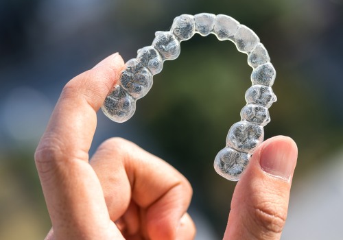 Exploring Payment Plans for Invisalign
