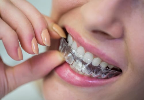 Everything You Need to Know About Dental Savings Plans for Invisalign