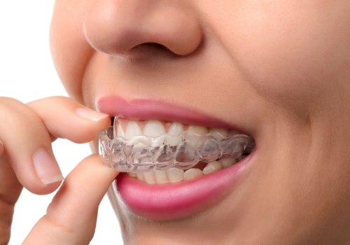 Cost of Invisalign in the US