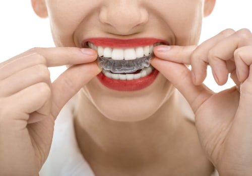 Adjusting to Wearing Aligners