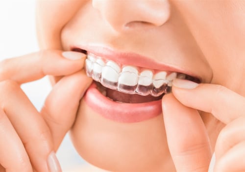 What Does Invisalign Cost in Canada?