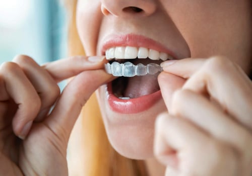 Invisalign Savings Programs: Exploring Your Options